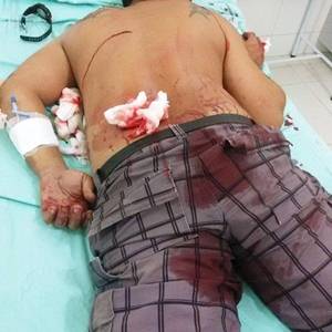 FOTO: Polícia Militar de Itapoá.