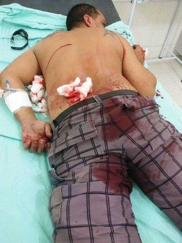 FOTO: Polícia Militar de Itapoá.