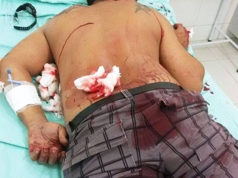 PM atende duas tentativas de homicídio na madrugada desta sexta (25-09)