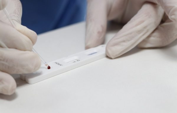 teste_rapido_novo_coronavirus__covid-19_20200504_1524810242