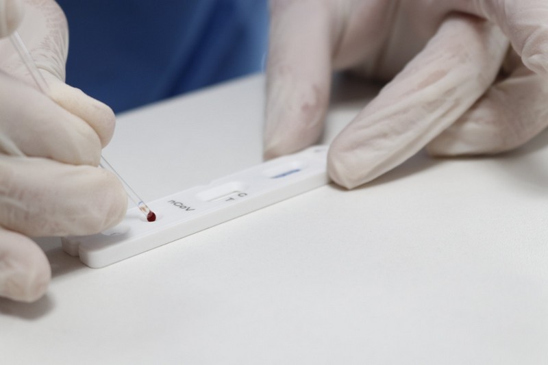 teste_rapido_novo_coronavirus__covid-19_20200504_1524810242