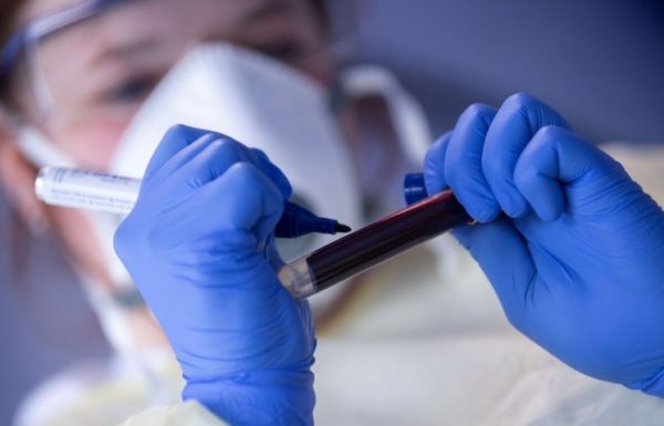 Momento exige que populacao continue tomando todos os cuidados relacionados a covid-19 (Tribuna de Itapoa)